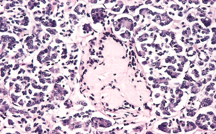 16 General Characterisation Of Amyloidosis Physico Chemical