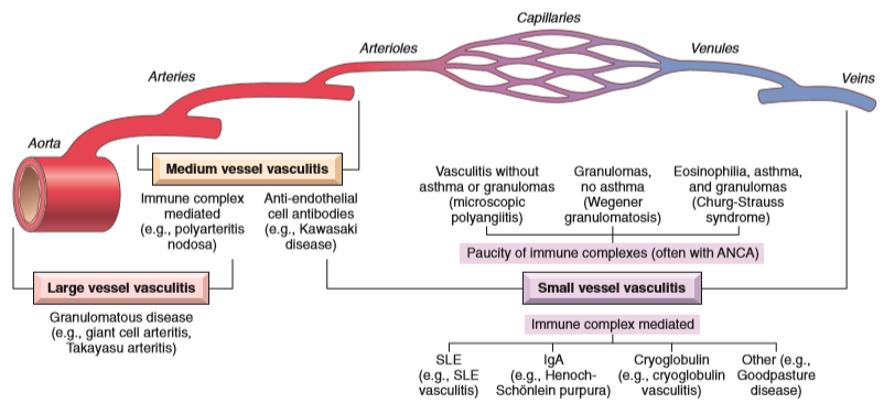 vasculitis classification