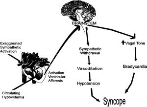 vasovagal syncope after drinking alcohol