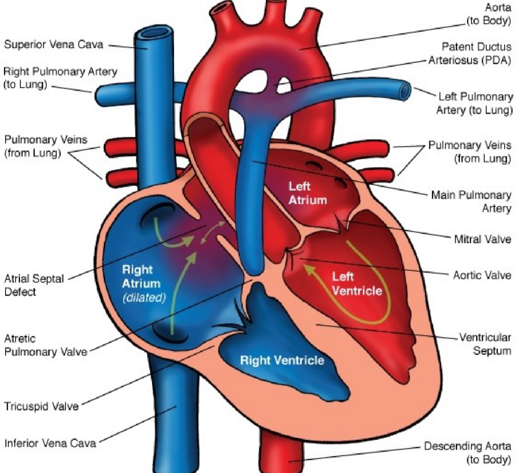 73. Congenital heart diseases – greek.doctor