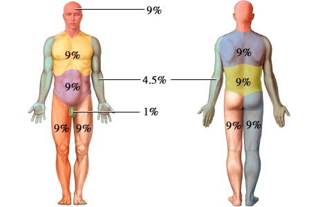 Determining Total Body Surface Area - Minnesota Dept. of Health