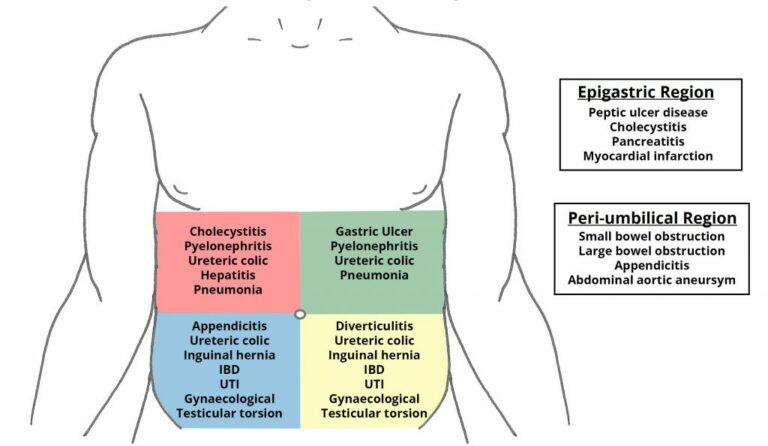 64. The ileus. Types of peritonitis. The acute abdomen – greek.doctor